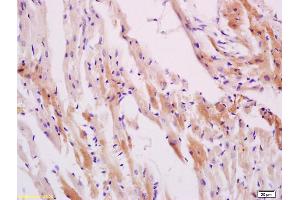 Formalin-fixed and paraffin embedded smooth muscle of rat stomach labeled with Anti-Phospho-HSP27(Ser78) Polyclonal Antibody, Unconjugated (ABIN685303) at 1:200 followed by conjugation to the secondary antibody and DAB staining (HSP27 Antikörper  (pSer78))