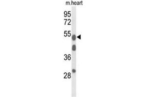 Western blot analysis of A1BG Antibody (Center) in mouse heart tissue lysates (35 µg/lane). (A1BG Antikörper  (Middle Region))