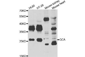 Western blot analysis of extracts of various cell lines, using GCA antibody (ABIN5974261) at 1/1000 dilution. (Grancalcin Antikörper)