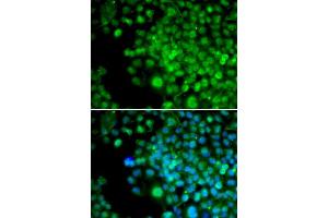 Immunofluorescence analysis of HeLa cells using FHL1 antibody (ABIN5973173). (FHL1 Antikörper)