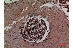 Immunohistochemistry (IHC) image for anti-Intercellular Adhesion Molecule 3 (ICAM3) (Internal Region) antibody (ABIN6282682)