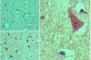 Image no. 1 for anti-ArfGAP with GTPase Domain, Ankyrin Repeat and PH Domain 2 (AGAP2) (AA 20-60) antibody (ABIN960073) (AGAP2 Antikörper  (AA 20-60))