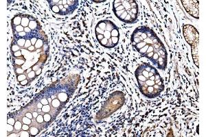 IHC analysis of HSPA6 using anti-HSPA6 antibody (ABIN7601944). (HSPA6 Antikörper  (AA 516-643))
