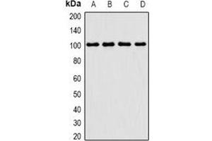 Western blot analysis of PIMT expression in Jurkat (A), MCF7 (B), mouse thymus (C), mouse testis (D) whole cell lysates.