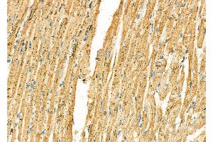 ABIN6265015 and ABIN6277239 at 1/100 staining Rat heart tissue by IHC-P. (SERPINH1 Antikörper  (Internal Region))
