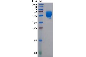Human CD83 Protein, hFc Tag on SDS-PAGE under reducing condition.