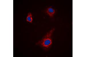 Immunofluorescent analysis of ATG4C staining in K562 cells. (ATG4C Antikörper  (N-Term))