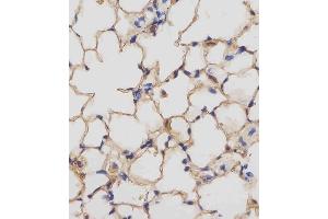 (ABIN657832 and ABIN2846797) staining Mouse Csf1r in mouse lung tissue sections by Immunohistochemistry (IHC-P - paraformaldehyde-fixed, paraffin-embedded sections).