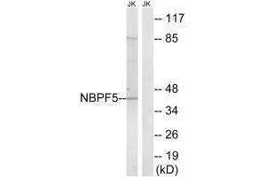 Western blot analysis of extracts from Jurkat cells, using NBPF5 antibody. (NBPF5 Antikörper  (C-Term))