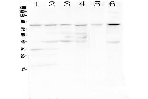 Western blot analysis of CD19 using anti-CD19 antibody . (CD19 Antikörper  (AA 19-237))