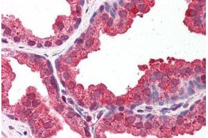 Human Prostate: Formalin-Fixed, Paraffin-Embedded (FFPE) (DYRK1A Antikörper  (AA 22-71))