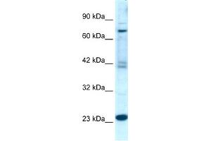 WB Suggested Anti-RGS10 Antibody Titration:  0.