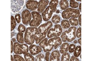 ABIN6266563 at 1/100 staining human kidney tissue sections by IHC-P.