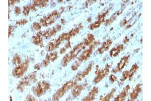 Image no. 2 for anti-Tumor Necrosis Factor alpha (TNF alpha) antibody (ABIN6171941) (TNF alpha Antikörper)