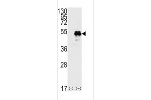Western blot analysis of TP53(arrow) using rabbit polyclonal p53 Antibdoy (T55) (ABIN390200 and ABIN2840687). (p53 Antikörper  (AA 33-62))