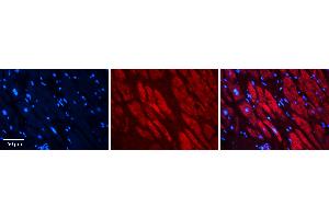 Rabbit Anti-RAD23B Antibody Catalog Number: ARP56505_P050 Formalin Fixed Paraffin Embedded Tissue: Human heart Tissue Observed Staining: Cytoplasmic Primary Antibody Concentration: 1:100 Other Working Concentrations: N/A Secondary Antibody: Donkey anti-Rabbit-Cy3 Secondary Antibody Concentration: 1:200 Magnification: 20X Exposure Time: 0. (RAD23B Antikörper  (Middle Region))