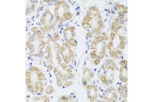 Immunohistochemistry of paraffin-embedded human stomach using MIP antibody (ABIN3016917, ABIN3016918, ABIN3016919 and ABIN6219879) at dilution of 1:100 (40x lens). (Mip (AA 50-150) Antikörper)