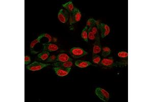 Immunofluorescence Analysis of HePG2 cells labeling GRP94 with GRP94 Rat Monoclonal Antibody (9G10. (GRP94 Antikörper)