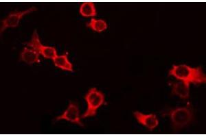 ABIN6268688 staining HeLa by IF/ICC. (IL-4 Antikörper  (Internal Region))
