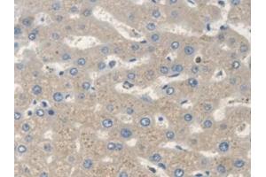 Immunohistochemistry (IHC) image for anti-Scavenger Receptor Class A, Member 5 (SCARA5) (AA 118-495) antibody (ABIN7441460)