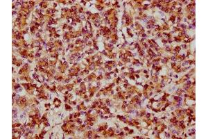 Immunohistochemistry (IHC) image for anti-Heat Shock 27kDa Protein 1 (HSPB1) antibody (ABIN7127557)