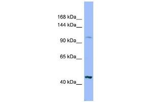 WB Suggested Anti-XYLT2 Antibody Titration:  0. (XYLT2 Antikörper  (Middle Region))