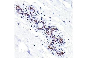 Immunohistochemistry of paraffin-embedded human breast using CDKN1B/p27KIP1 Rabbit mAb (ABIN7266602) at dilution of 1:100 (40x lens). (CDKN1B Antikörper)