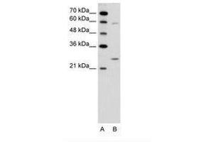 Image no. 1 for anti-Guanidinoacetate N-Methyltransferase (GAMT) (N-Term) antibody (ABIN6736619) (GAMT Antikörper  (N-Term))