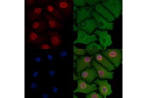 ABIN6257185 and ABIN6274308 staining Hela cells by IF/ICC. (Foxk1 Antikörper  (Internal Region))