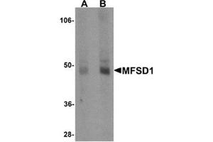 Western blot analysis of MFSD1 in human lung tissue lysate with MFSD1 antibody at (A) 1 and (B) 2 μg/ml. (MFSD1 Antikörper  (Center))