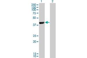 Western Blot analysis of CAMK1D expression in transfected 293T cell line by CAMK1D monoclonal antibody (M10), clone 3H8. (CAMK1D Antikörper  (AA 1-95))