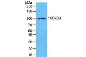 Figure. (Nuclear Factor kappa B2 (AA 38-343) Antikörper)