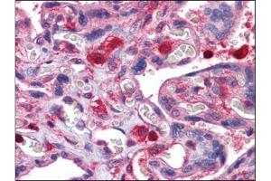 Human Placenta: Formalin-Fixed, Paraffin-Embedded (FFPE) (GDI2 Antikörper)