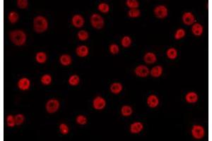 ABIN6266615 staining HepG2 by IF/ICC. (Cyclin L1 Antikörper  (C-Term))