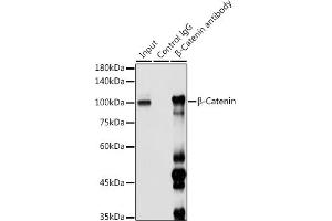 Immunoprecipitation analysis of 300 μg extracts of 293T cells using 3 μg β-Catenin antibody (ABIN6134299, ABIN6139205, ABIN6139208 and ABIN6215244). (CTNNB1 Antikörper  (AA 1-100))