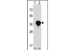 Western blot analysis of TALDO1 (arrow) using rabbit polyclonal TALDO1 Antibody (Center) (ABIN390629 and ABIN2840933). (TALDO1 Antikörper  (AA 186-215))