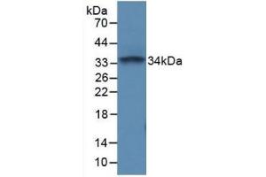 Detection of Recombinant PTPRC, Mouse using Polyclonal Antibody to Protein Tyrosine Phosphatase Receptor Type C (CD45) (CD45 Antikörper  (AA 371-556))