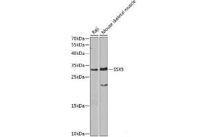 Western blot analysis of extracts of various cell lines using SSX5 Polyclonal Antibody at dilution of 1:1000. (SSX5 Antikörper)