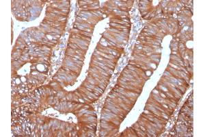 Immunohistochemistry (IHC) image for anti-Calpastatin (CAST) antibody (ABIN6940960)