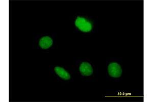 Immunofluorescence of purified MaxPab antibody to ZNF509 on HeLa cell. (ZBTB49 Antikörper  (AA 1-248))