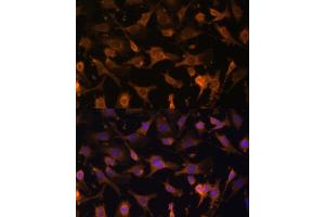 Immunofluorescence (IF) image for anti-Ubiquitin-Fold Modifier Conjugating Enzyme 1 (UFC1) (AA 1-167) antibody (ABIN6149886)