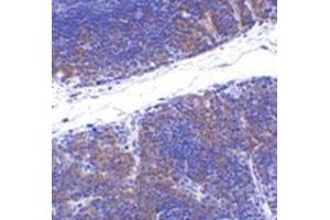 Immunohistochemistry of TNFRSF14 in mouse thymus tissue with this product at 1 μg/ml. (HVEM Antikörper  (N-Term))