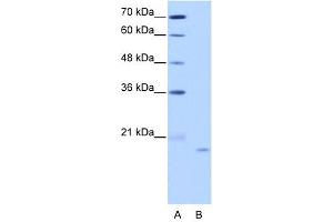 NOL6 antibody used at 2.