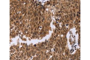 Immunohistochemistry (IHC) image for anti-Excision Repair Cross-Complementing Rodent Repair Deficiency, Complementation Group 6-Like (ERCC6L) antibody (ABIN2423389) (ERCC6L Antikörper)