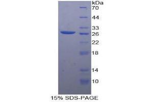 SDS-PAGE (SDS) image for Nectin cell adhesion molecule 3 (NECTIN3) (AA 171-377) protein (His tag) (ABIN2126377)