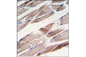 Image no. 1 for anti-Desmin (DES) antibody (ABIN357901) (Desmin Antikörper)