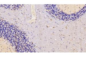 Immunohistochemistry (IHC) image for anti-Ionized Calcium-binding Adapter Molecule 1 (IBA1) (AA 1-147) antibody (ABIN7437545)