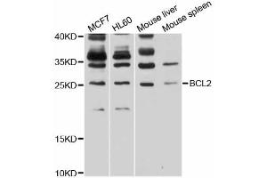 Western blot analysis of extracts of various cell lines, using BCL2 antibody (ABIN6291793) at 1:1000 dilution. (Bcl-2 Antikörper)