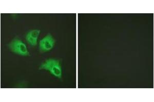 Immunofluorescence analysis of HeLa cells, using Kir5. (KIR5.1 Antikörper  (pSer417))