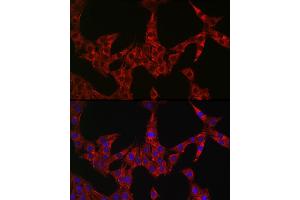 Immunofluorescence analysis of PC-12 cells using GSDME antibody (ABIN6127757, ABIN6139554, ABIN6139555 and ABIN6223304) at dilution of 1:50. (Non-Syndromic Hearing Impairment Protein 5 (GSDME) (AA 1-260) Antikörper)
